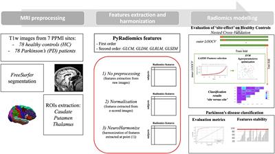 The impact of harmonization on radiomic features in Parkinson’s disease and healthy controls: A multicenter study